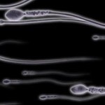 sperm