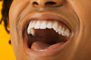 tooth protect