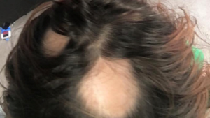 hair care