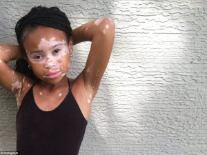 ten yr old skin